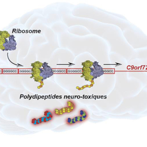 Le mécanisme moléculaire responsable du développement de la maladie de Charcot dévoilé