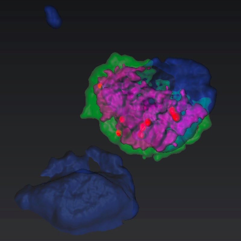 Macrophages M4: a new type of reservoir to be targeted to eradicate HIV-1