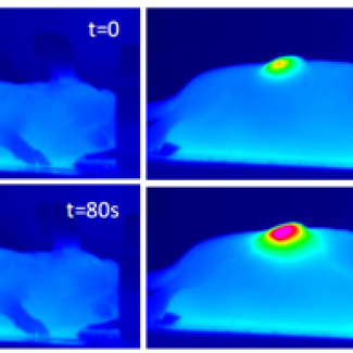 Nanohyperthermia softens tumors to improve treatment